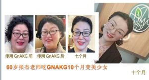 Read more about the article 🧬 从“细胞燃料”到“逆龄黑马”——揭秘AKG抗衰老的科学真相