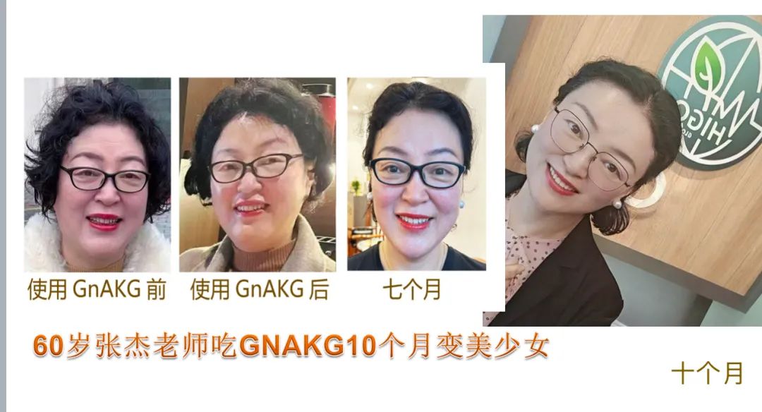 Read more about the article 🧬 从“细胞燃料”到“逆龄黑马”——揭秘AKG抗衰老的科学真相